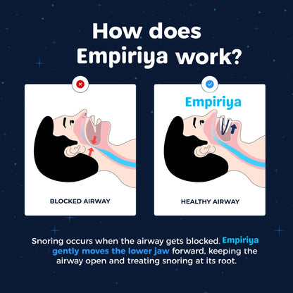 Empiriya™ Adjustable  Anti-Snoring Mouthpiece