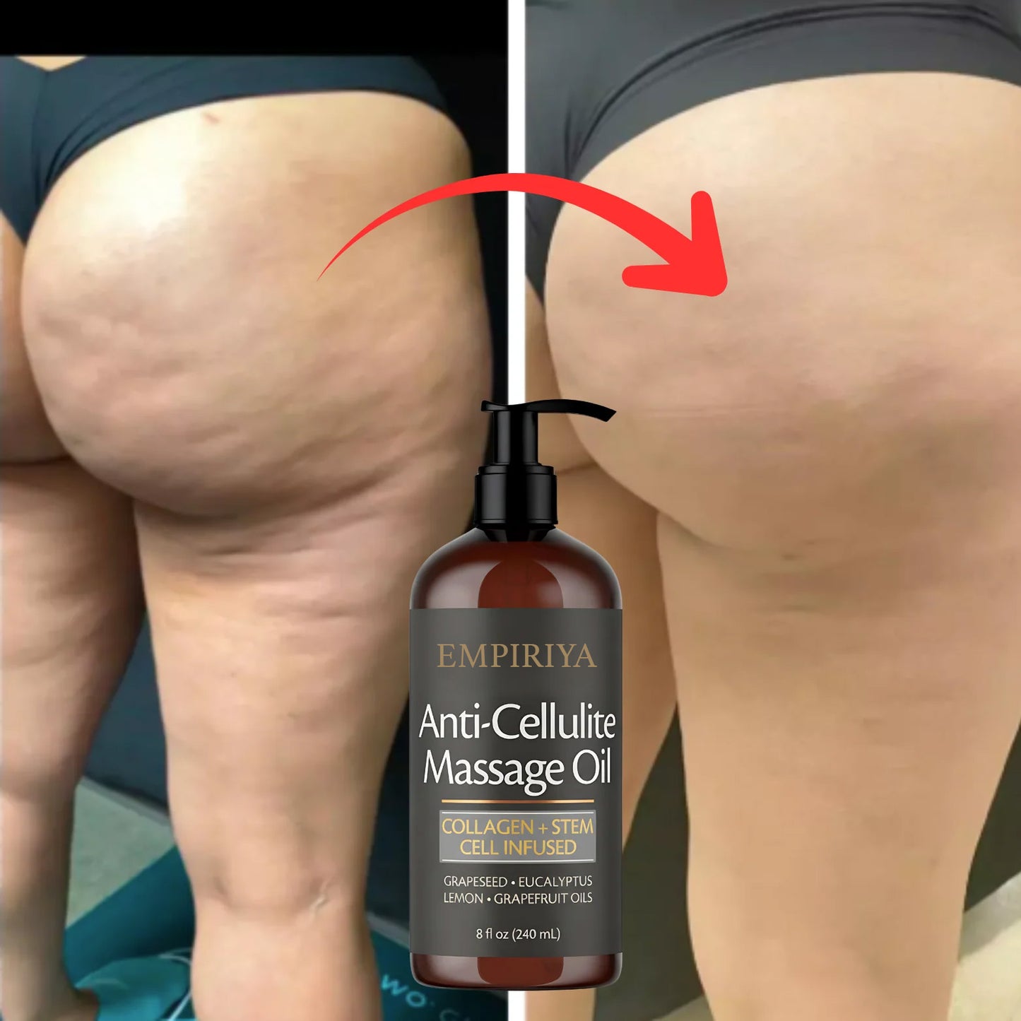 EMPIRIYA Lymph-Aktiv Massageöl – Sichtbar Straffere Haut durch Tägliche Lymph-Massage